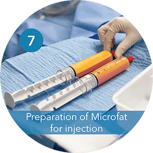 Step 7 Perp of microfat